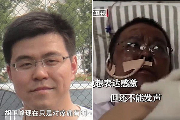 Bác sĩ Trung Quốc đổi màu da vì Covid-19 qua đời