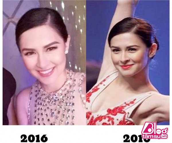 6 năm tuy không quá dài nhưng cũng đủ để thay đổi rất nhiều thứ. Thế mà nhan sắc của “mỹ nhân đẹp nhất Philippines” dường như cũng chẳng khác đi chút nào.