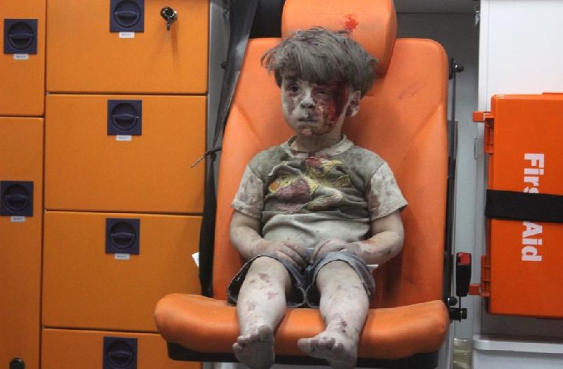 Gương mặt bê bết máu của cậu bé Omran Daqneesh, 5 tuổi, trở thành một trong những lời cảnh báo về những hậu quả của cuộc nội chiến đang diễn ra tại Syria. Ngôi nhà của Daqneesh hoàn toàn bị phá hủy trong vụ không kích ngày 17/8 tại vùng Qaterj thuộc Aleppo.