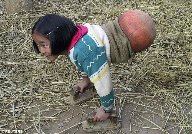 Và mọi người dần quen gọi Qian là “cô gái bóng rổ”.  Năm 2005, khi Qian lên 10, cô bé trở thành một hiện tượng Internet sau khi những bức ảnh được đăng tải trên mạng xã hội.  Cư dân mạng và dư luận Trung Quốc ấn tượng với những nỗ lực của Qian. Sự nổi tiếng bất đắc dĩ này giúp Qian nhận được một đôi chân giả miễn phí từ Trung tâm Phục hồi Trung Quốc ở Bắc Kinh.  Năm 2007, cô bé nhận được một đôi chân lớn hơn.