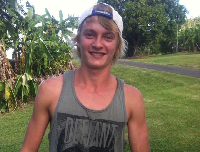 Thanh niên người Australia suýt mất cánh tay vì sự dại dột của mình. Ảnh: 