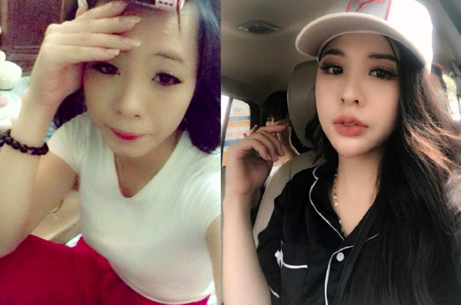 Nhan sắc của Nguyễn Thị Trang trước và sau khi phẫu thuật thẩm mỹ. 