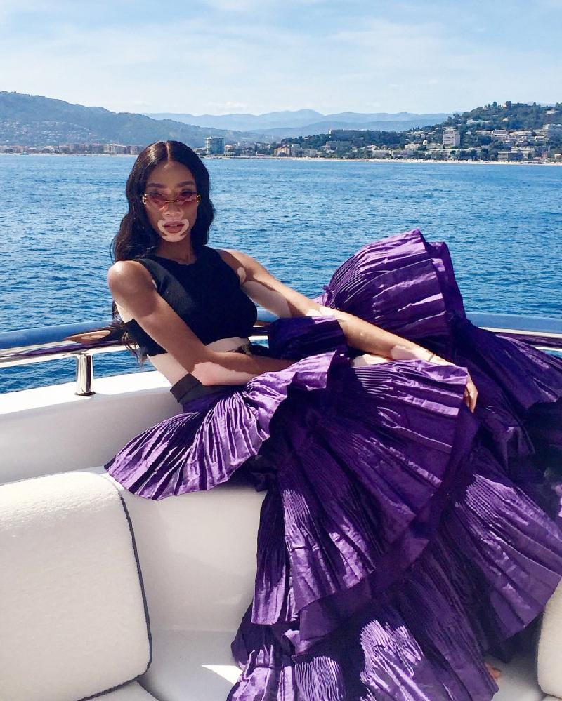 Năm nay, chân dài bạch biến Winnie Harlow cũng có màn xuất hiện ấn tượng trên thảm đỏ LHP Cannes. Với vẻ đẹp khác biệt, cô đang có những bước tiến vững chắc trong sự nghiệp người mẫu. 