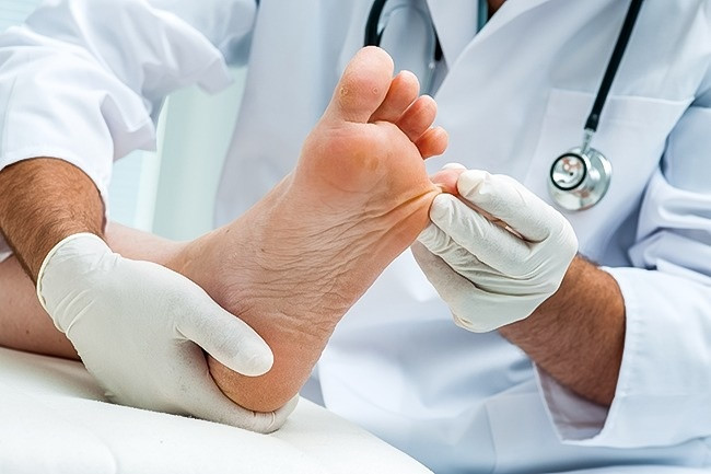 Tham khảo ý kiến bác sĩ: Nếu chân bạn không chỉ có mùi khó chịu mà còn bắt đầu ngứa và bong da, hãy đi khám bác sĩ. Đây có thể là triệu chứng của giun móc, nhiễm trùng hoặc bệnh nấm.