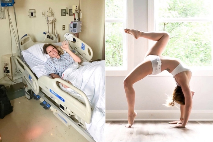 Người phụ nữ bị xé rách động mạch cổ khi cố tập Yoga